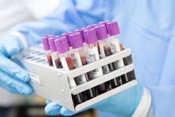 specialized diagnostic tests