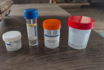 urine and stool sample collection at home
